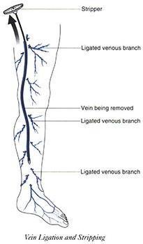 Anatomia żyły odpiszczelowej